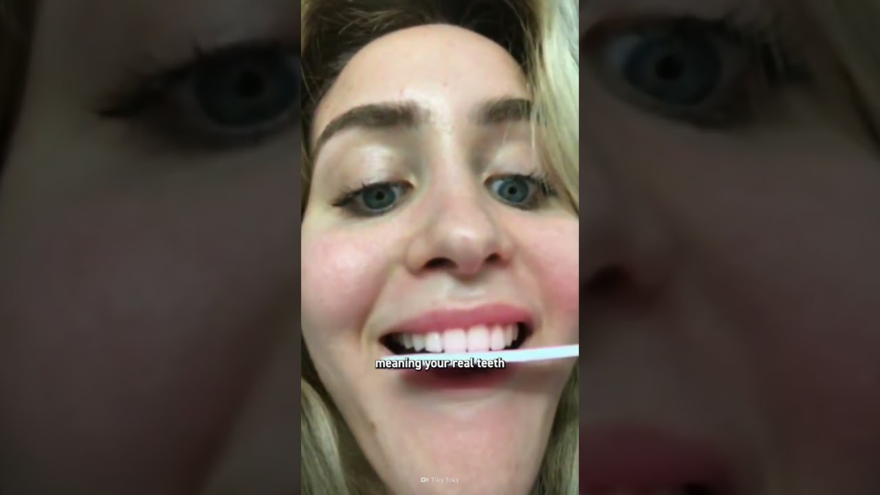 The Hidden Dangers Behind TikTok's Veneer Trend
