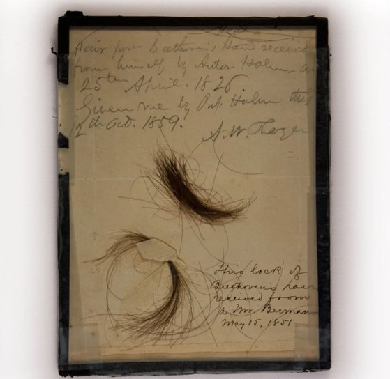 ベートーヴェンの聴覚障害、鉛中毒のためだった…髪の毛を分析した結果「反転」