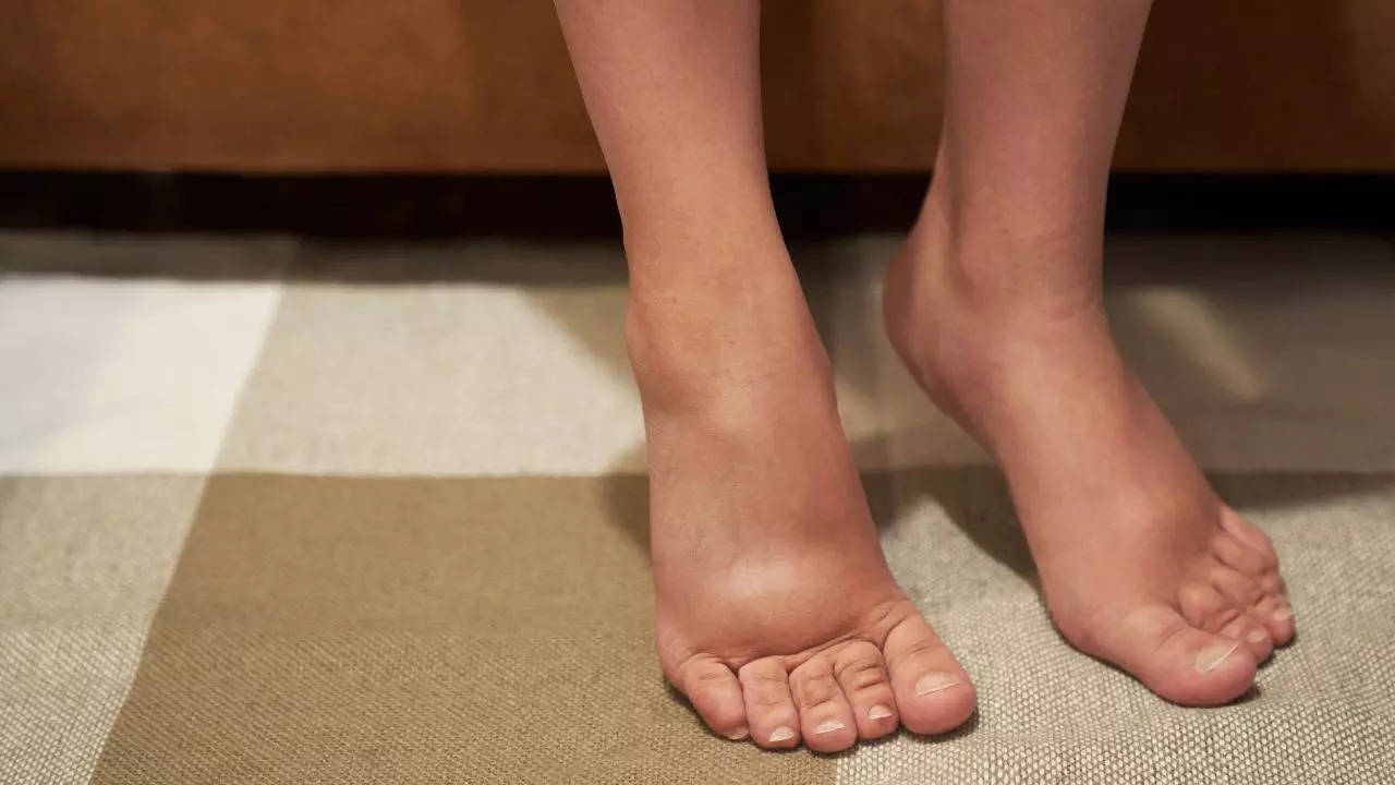 what causes your feet to swell when you sit for prolonged time?