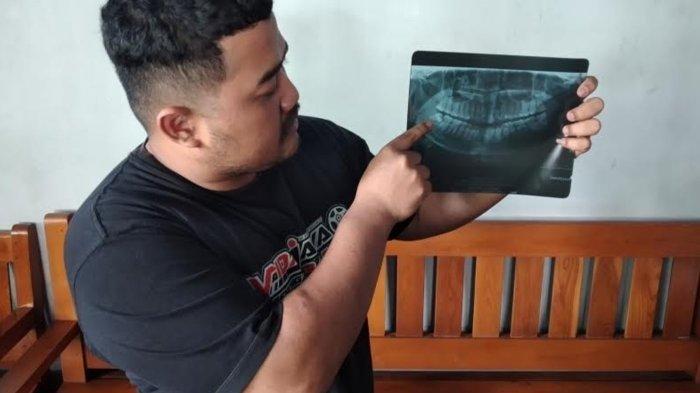 viral istri di ngawi meninggal usai cabut gigi bungsu di klinik,suami tuntut dokter tanggung jawab