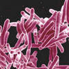 What to know about TB after outbreak in this city sickens 14 people<br>