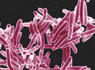 What to know about TB after outbreak in this city sickens 14 people<br><br>