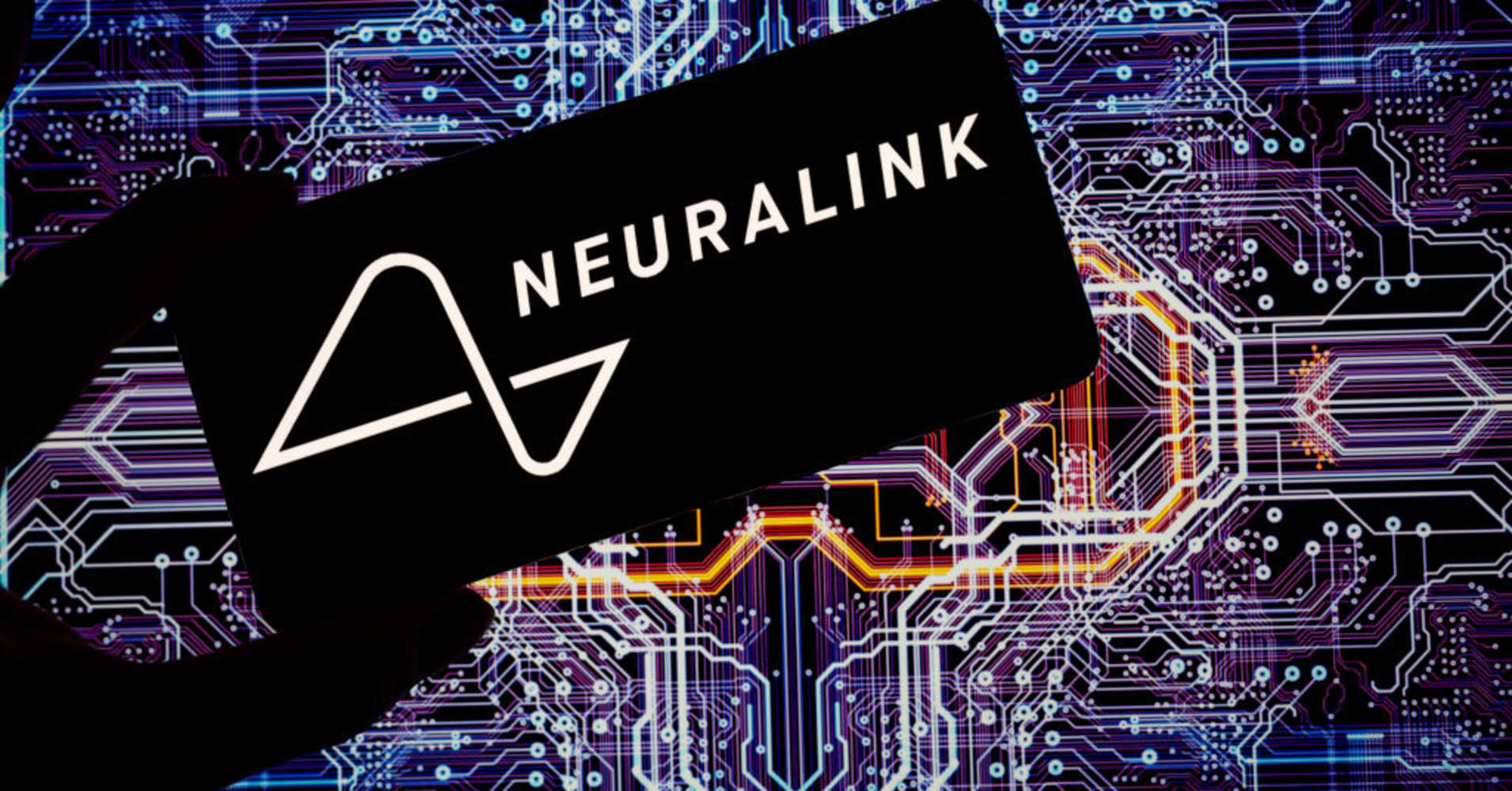 neuralink's first in-human brain implant has experienced a problem, company says