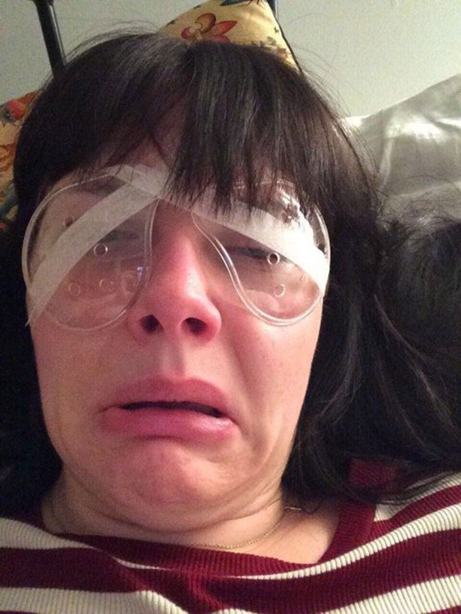 what it’s really like to have laser eye surgery