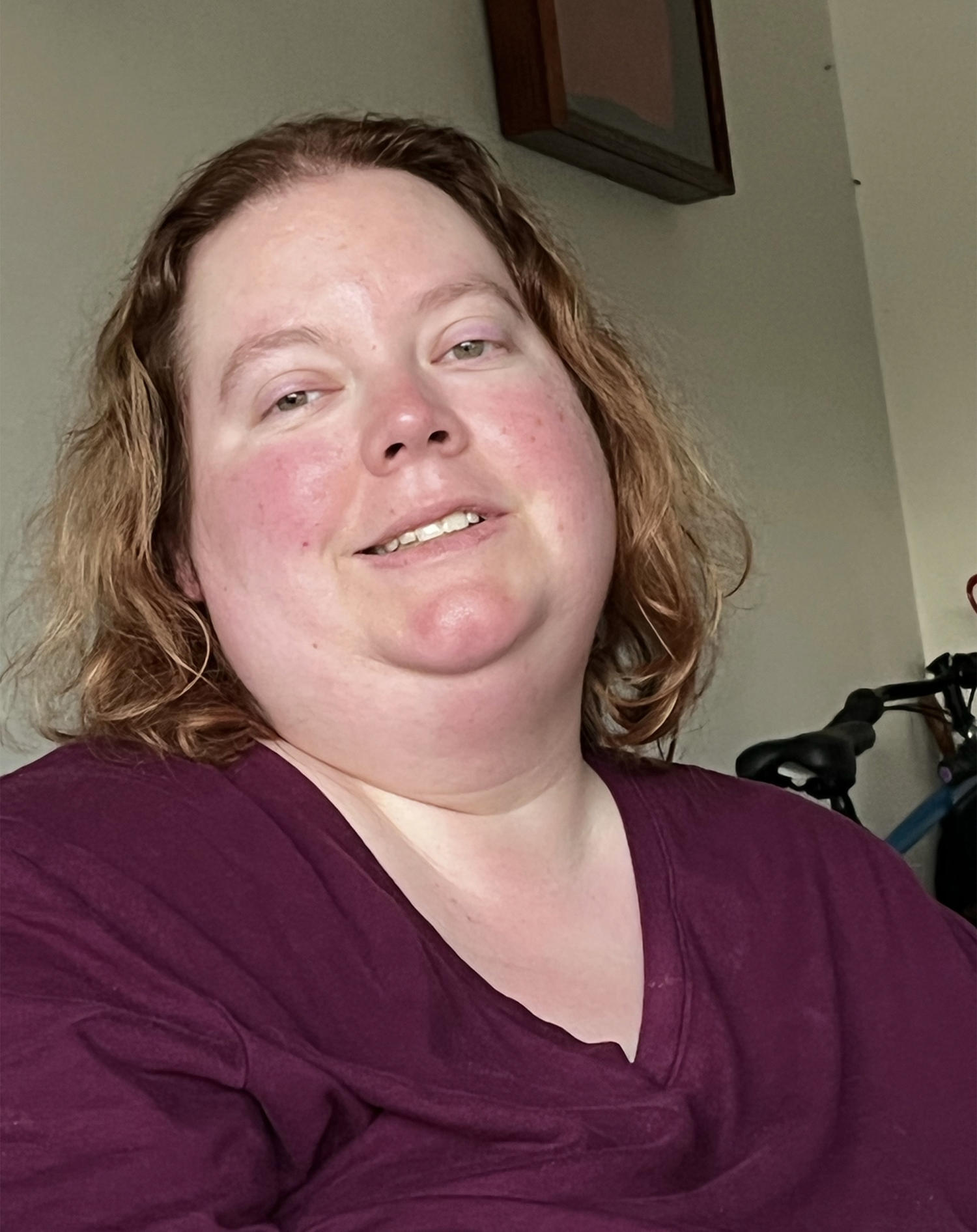 after losing 210 lbs with walking and a low-carb diet, 1 mom has 4 pounds of skin removed