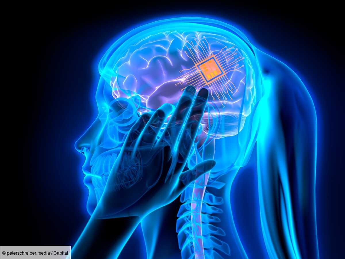 implant cérébral de neuralink : 100 jours après l’opération, le premier cobaye témoigne