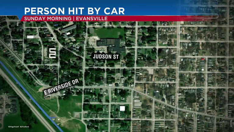 Epd Person Hospitalized After Being Hit By Car Near E Riverside Drive