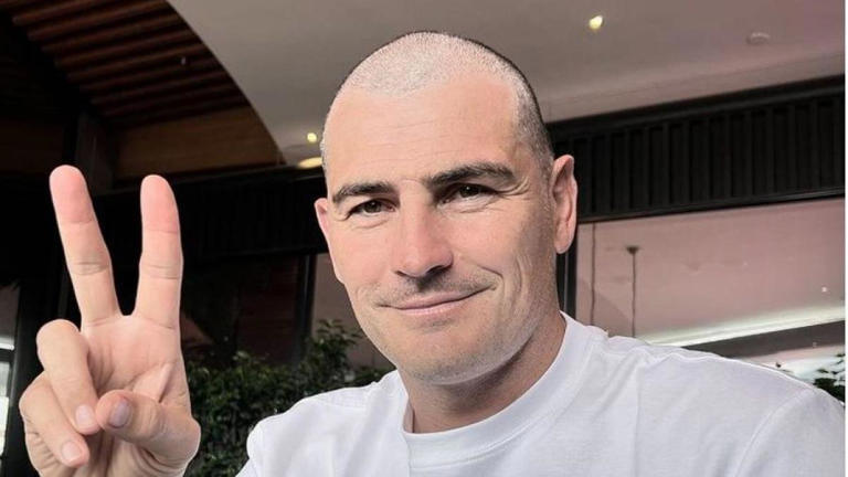 Iker Casillas no se hizo un trasplante de pelo no hace mucho???
