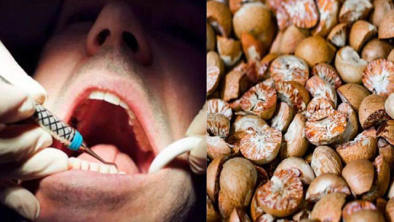 Betel Nut Mouth Cancer: आईआईटी इंदौर के प्रोफेसर ने सुपारी पर किया ...