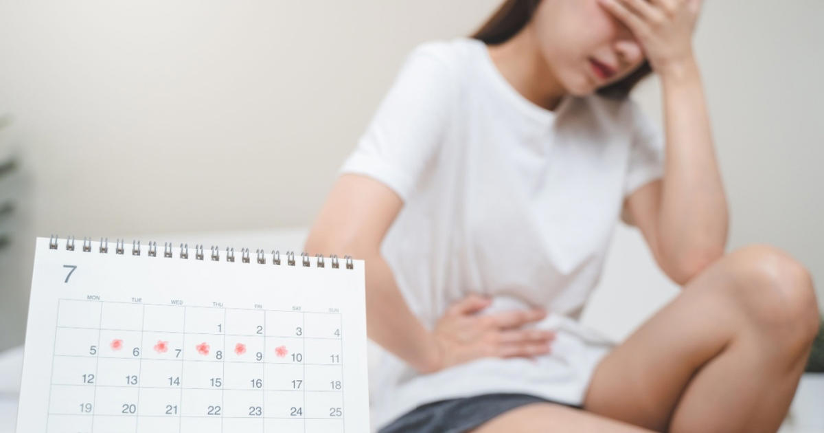 mange forsøger at stoppe menstruation med viral trend: eksperter er bekymret
