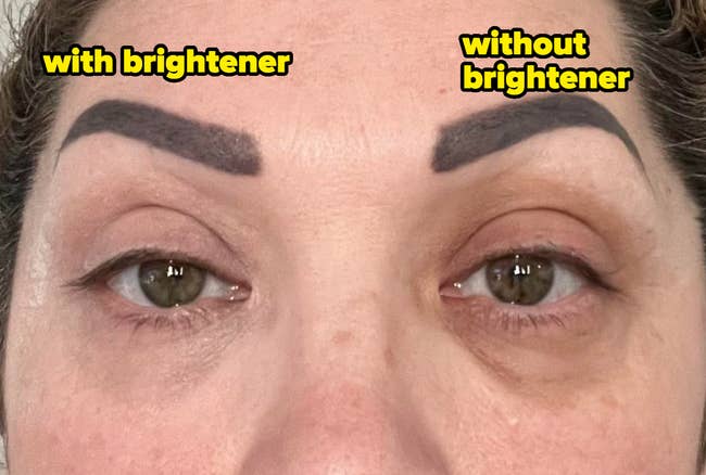 Close-up of a person with eye brightener on their left eye and without it on the right