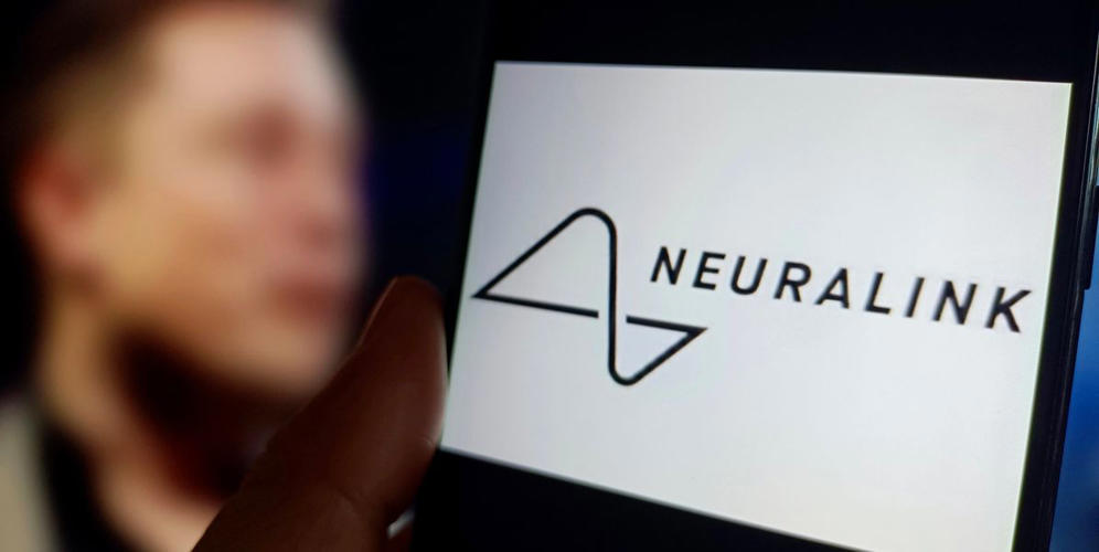 Neuralink Reveals Issues With First Human Brain Implant After Surgery