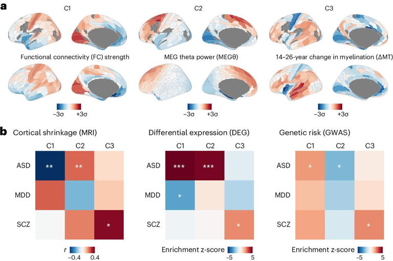 Three patterns of gene expression each align with distinct features of known neurobiology: C1 aligns with functional connectivity strength, C2 with brain oscillations in the theta-band range, and C3 with adolescent brain plasticity. Below, we show heatmaps (corrected for multiple comparisons) of the convergent associations between the three patterns C1-C3 and three mental health conditions – autism spectrum disorder (ASD), major depressive disorder (MDD), and schizophrenia (SCZ) – across three previously unrelated methods of analysis (cortical shrinkage from neuroimaging, differential gene expression from postmortem RNA sequencing, and genetic risk from genome-wide association studies), revealing autism to be consistently associated with C1 and C2, and schizophrenia to be consistently associated with C3. Credit:Nature Neuroscience(2024). DOI: 10.1038/s41593-024-01624-4.