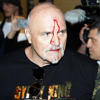 Tyson Fury’s father John suffers cut to head as Oleksandr Usyk fight week begins<br>