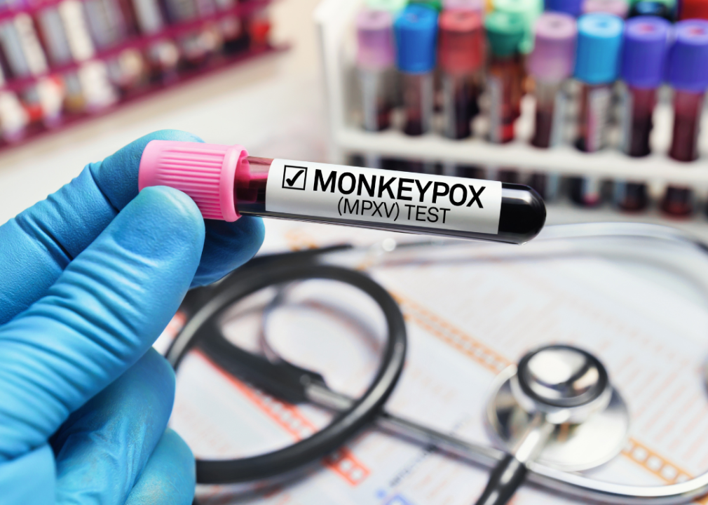 <p>Monkeypox—<a href="https://stacker.com/society/how-monkeypox-and-other-disease-names-have-caused-controversy">now known as mpox</a>—was launched back into the mainstream in 2022, when the World Health Organization declared a health emergency over an outbreak that eventually spanned 87,000 cases in 170 countries. First coined in 1960, it's a disease transmitted to people through physical contact with open wounds or bodily fluids from infected people or animals.</p>