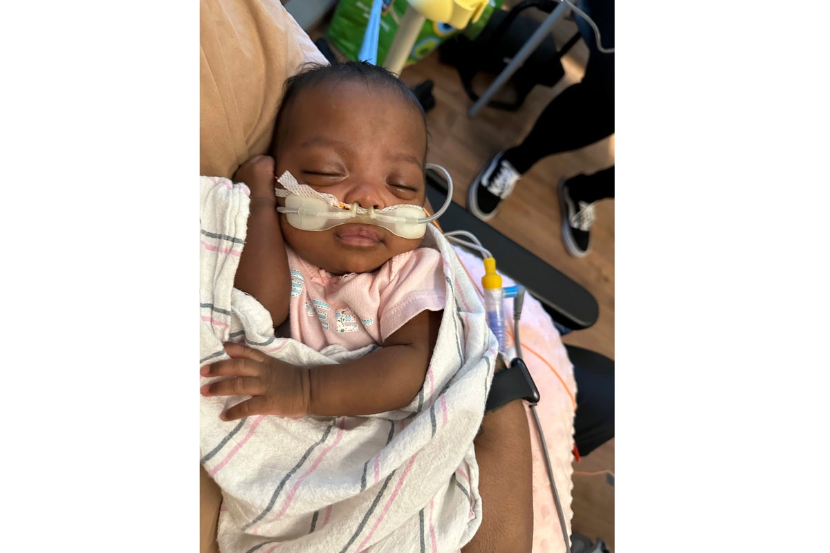 `Micropreemie' Baby Who Weighed Just Over 1 Pound At Birth Goes Home ...