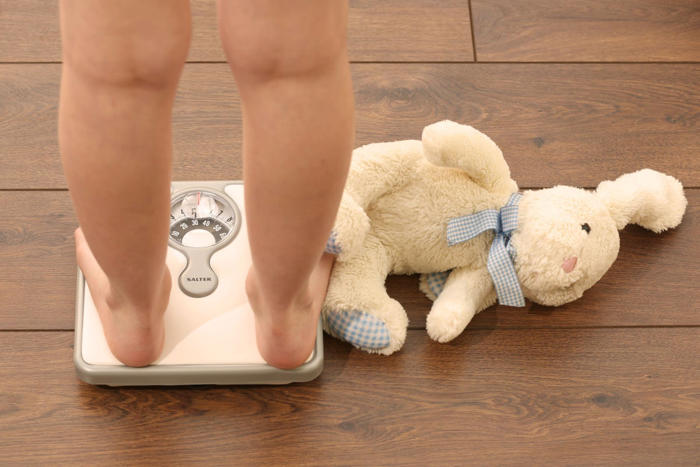 childhood obesity has ‘profound’ impact on life expectancy, researchers warn