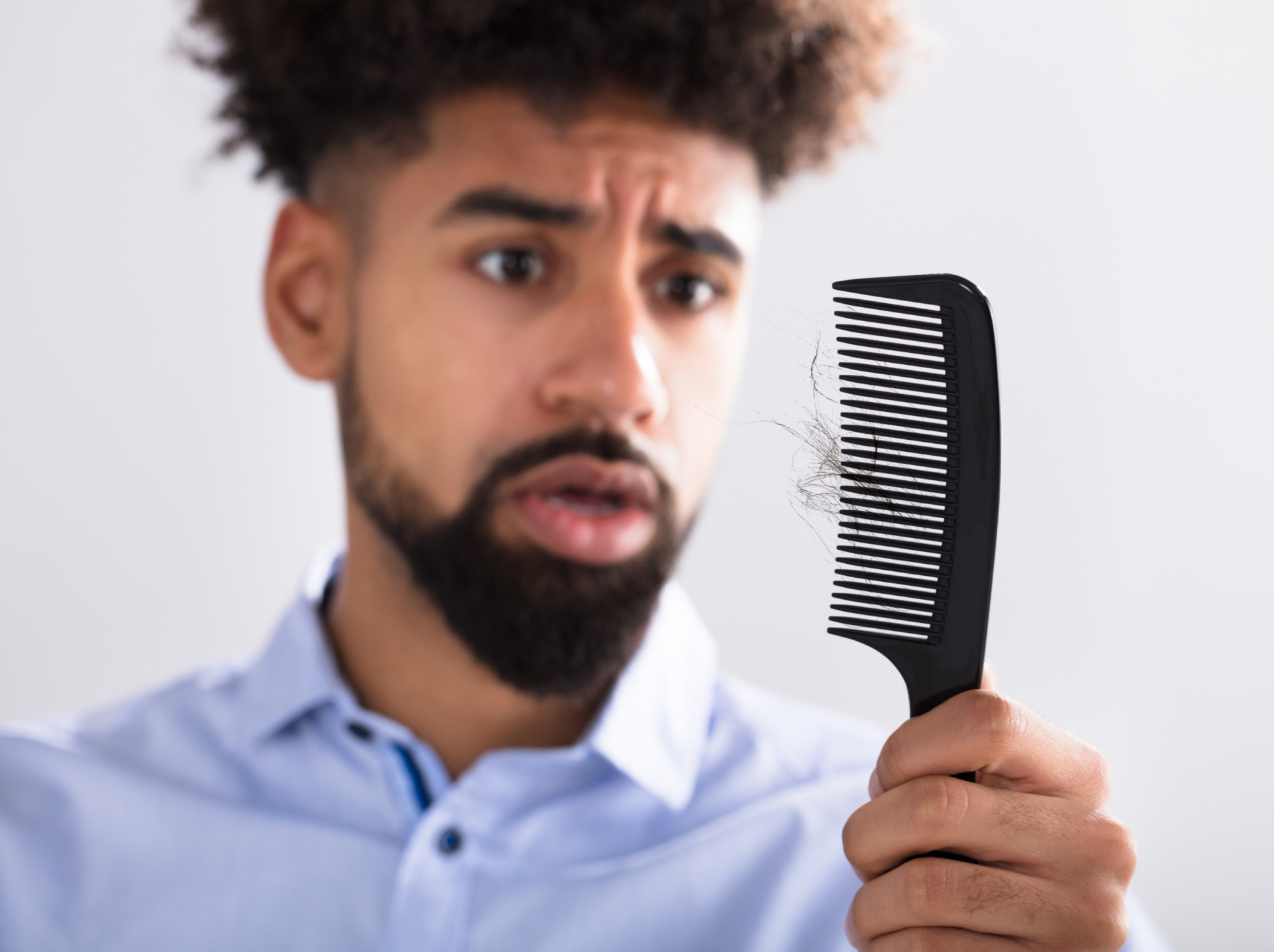 Pourquoi les jeunes perdent désormais leurs cheveux à 20 ans