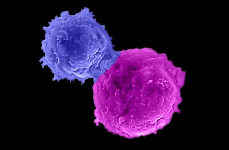 A microscopy image shows an enhanced natural killer T cell (blue) attacking a human multiple myeloma cell (magenta). Credit: Lili Yang lab/UCLA