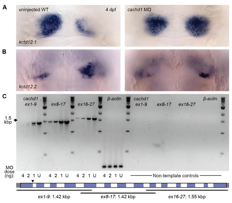 Key protein behind brain asymmetry uncovered by scientists