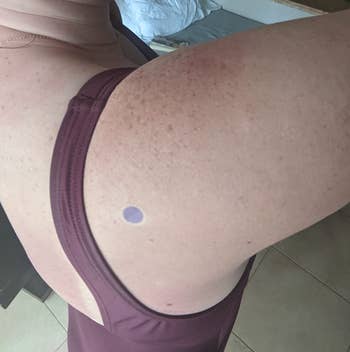 sunscreen sticker after being out, now dark