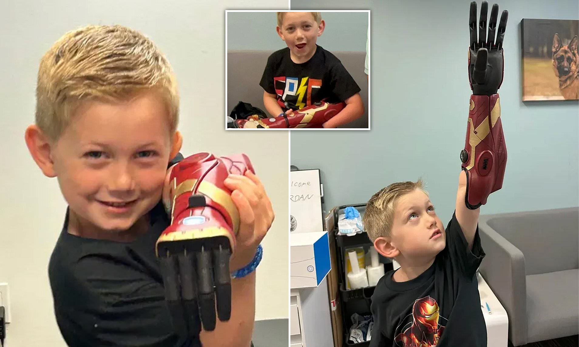 Boy, 5, Becomes Youngest In The World To Receive Bionic 'Ironman' Arm