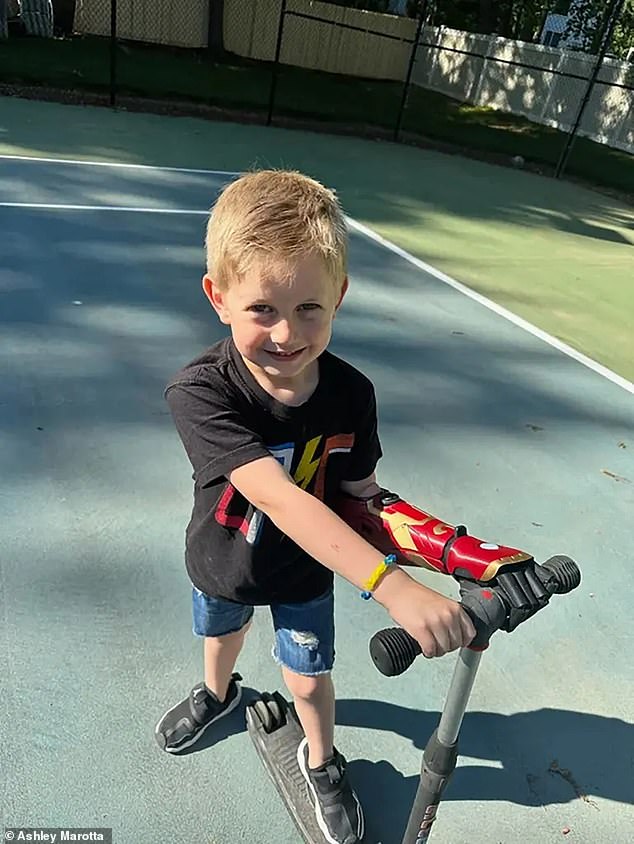 Boy, 5, Becomes Youngest In The World To Receive Bionic 'Ironman' Arm