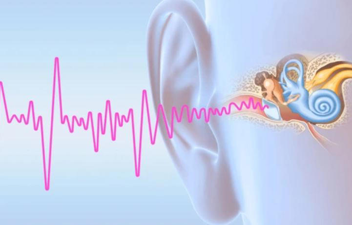 el tinnitus o acufenos o zumbido