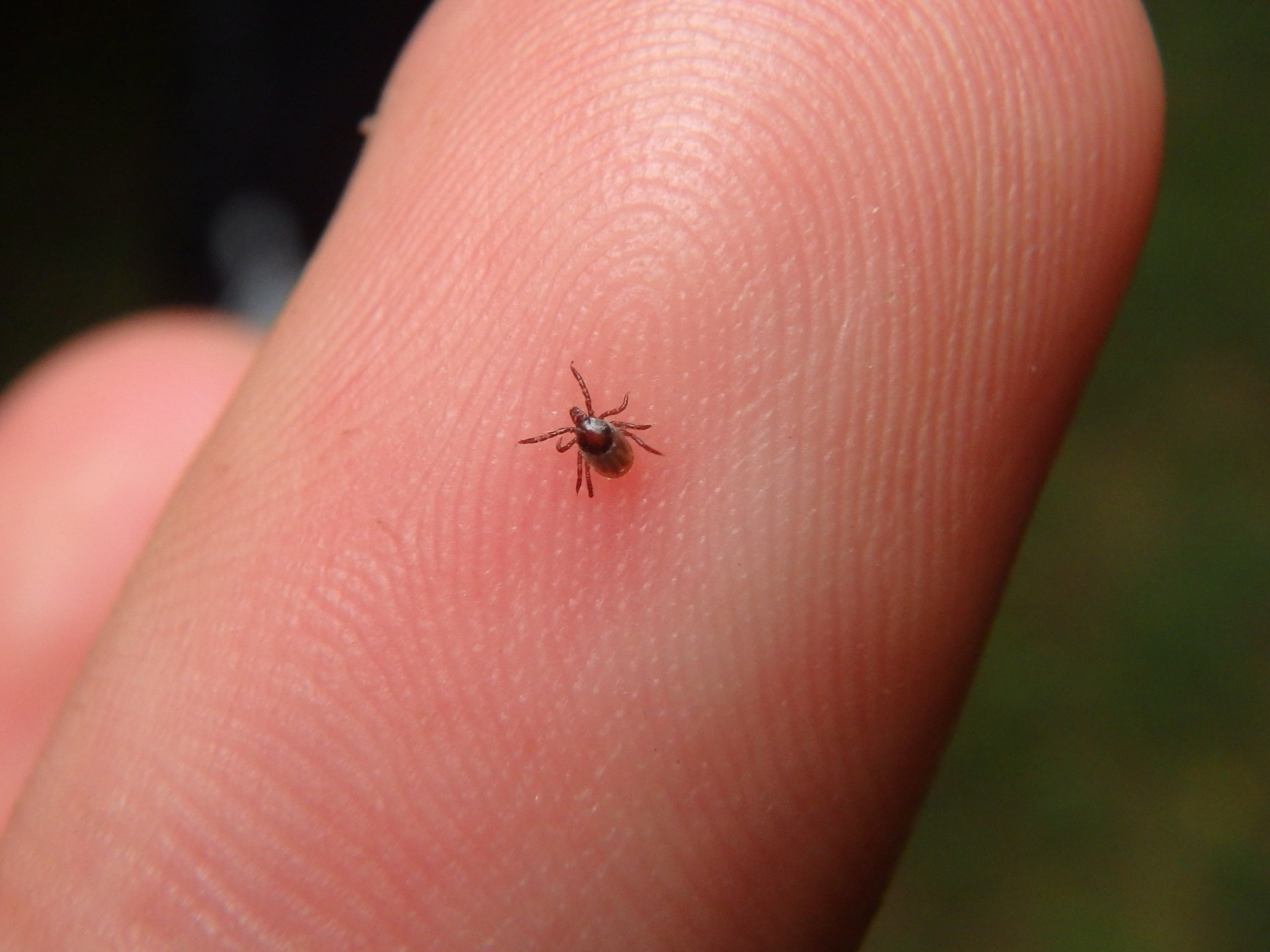 Babesiosis: How dangerous is this parasitic disease?