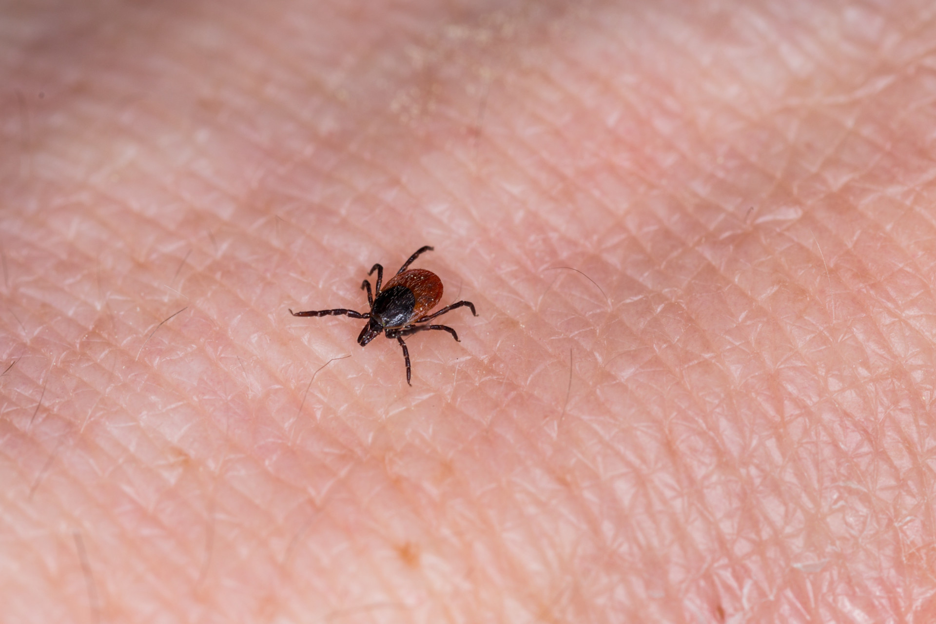 Babesiosis How dangerous is this parasitic disease?