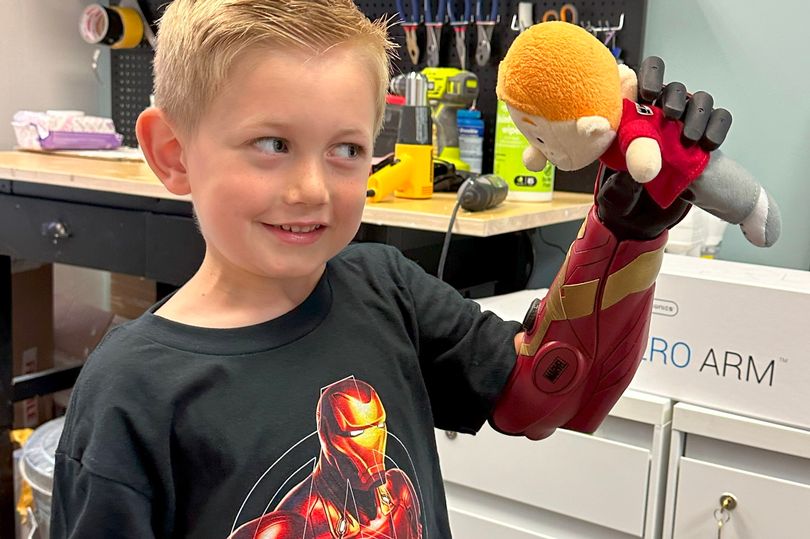 Boy, 5, Becomes The World's Youngest Person To Get A Futuristic Bionic Limb