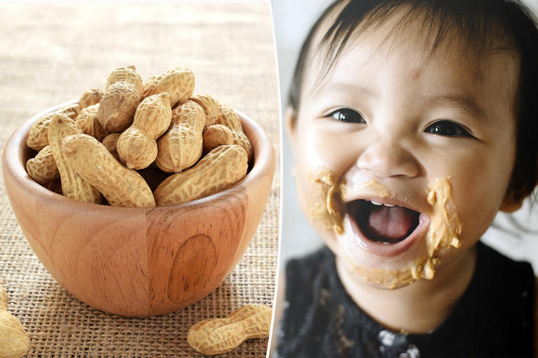 Introducing peanuts early reduces kids’ allergy risk: new study