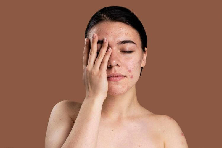 permasalahan kulit yang muncul saat cuaca panas dan cara mengatasinya