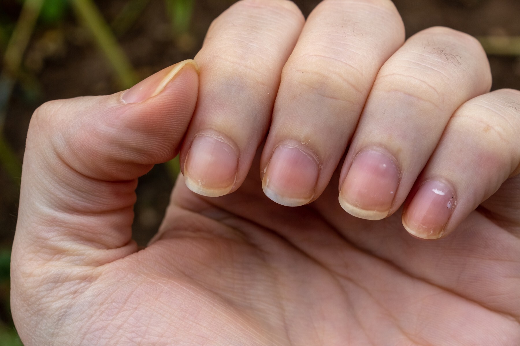What your nails can tell you about your health
