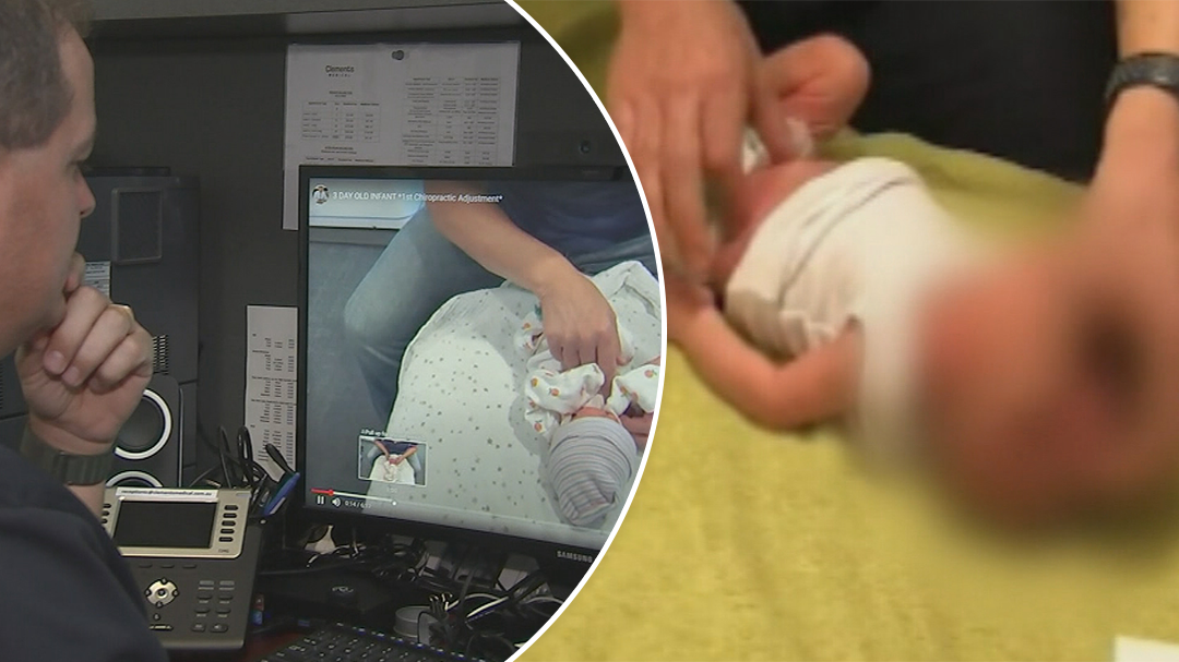 chiropractors reinstate ban on baby back cracking after outcry