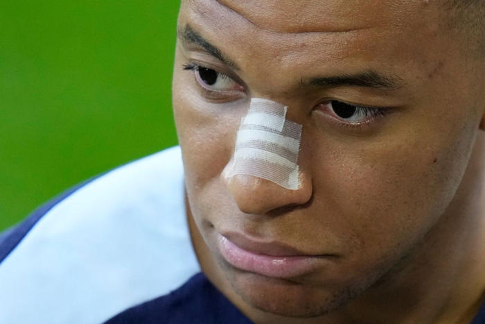 netherlands vs france lineups: kylian mbappe injury latest, predicted xis and euro 2024 team news