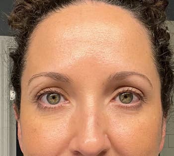 reviewer with forehead looking shiny