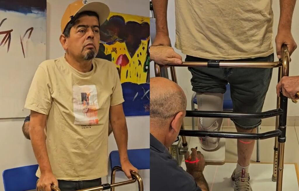 mostró su nueva prótesis: mauricio medina expone cómo ha sido el difícil proceso de su rehabilitación tras la amputación de la mitad de su pierna