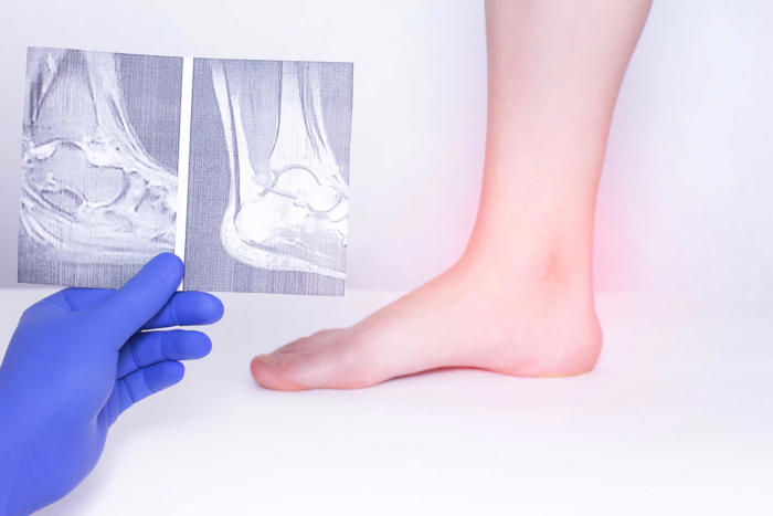 reaktivní artritida: varovné znaky, na které je třeba si dát pozor