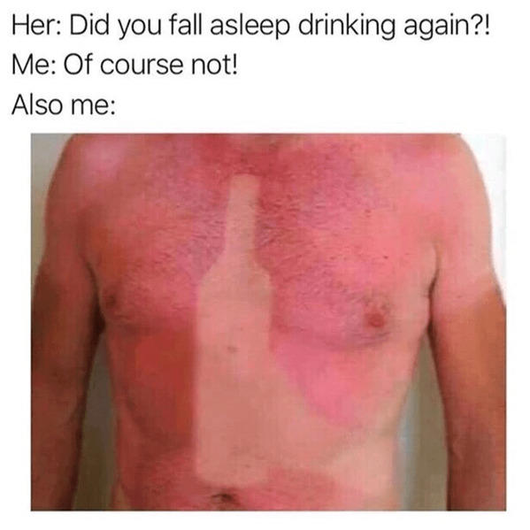 35 Funny Sunburn Memes That'll Have You Reaching For The Sunscreen ...