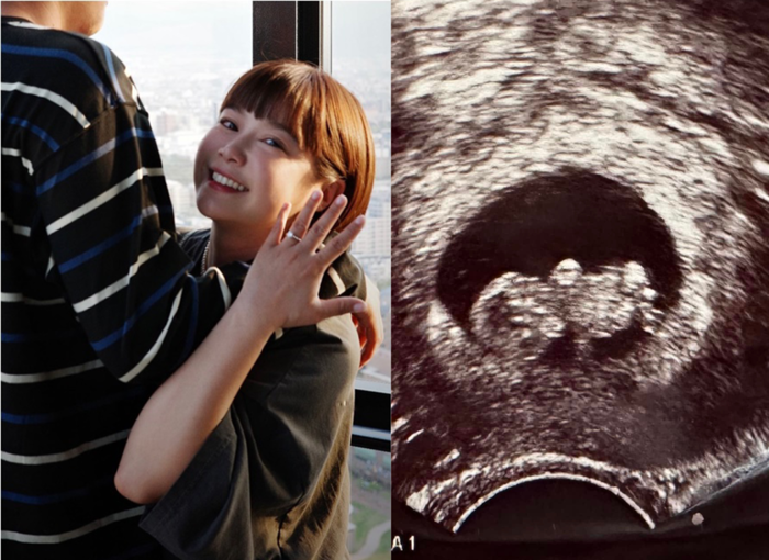 快訊／41歲李佳穎宣布懷孕5個月 初期大出血2次臥床安胎