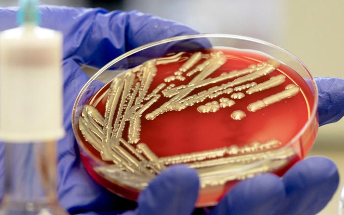 e. coli blamed on weather as food poisoning doubles
