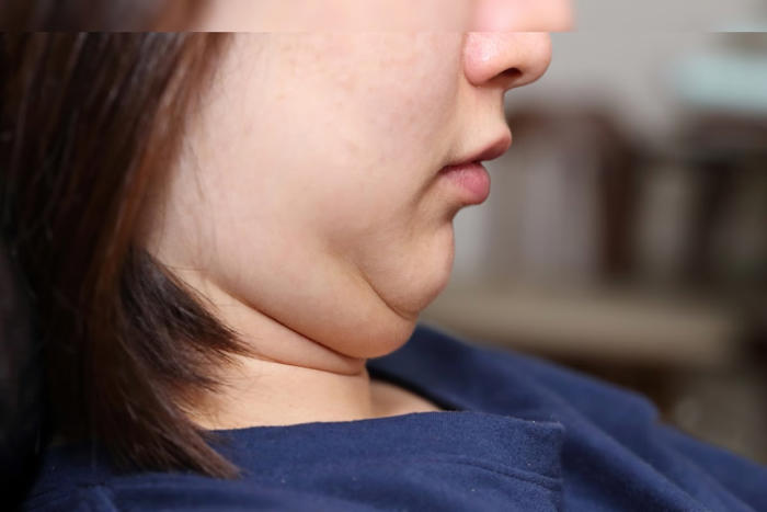 4 easy tips to reduce your double chin