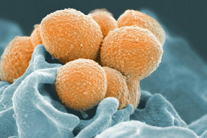 japan sees spike in disease caused by 'rare flesh-eating bacteria' that can kill within 48 hours