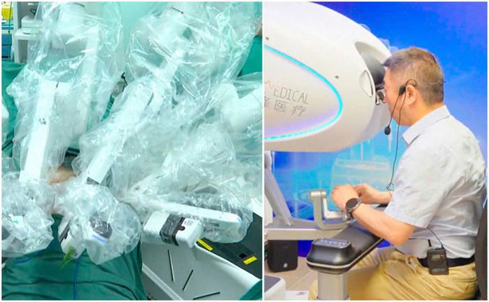 ¡impresionante avance medico! cirujano en roma realiza cirugía a paciente en china