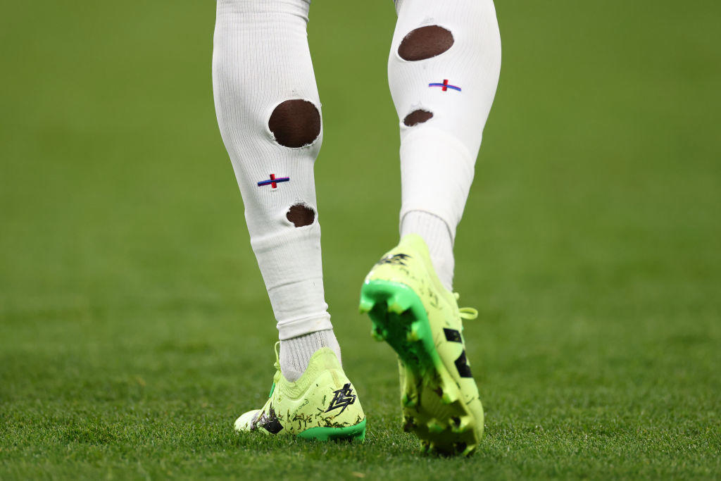 why do football players have holes in their socks at euro 2024?