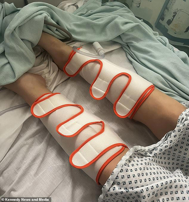 she thought pain was a pulled muscle... but scans revealed blood clots