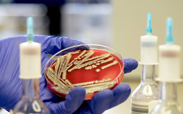 amazon, e. coli outbreak recall list: which products have customers been asked to return