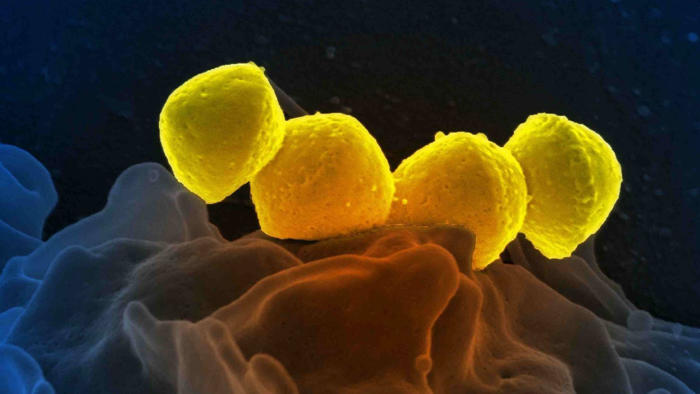 japón registra un aumento récord de infección bacteriana potencialmente mortal