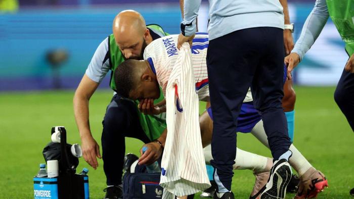 fotos: mbappé fica com o nariz em mau estado após choque com adversário